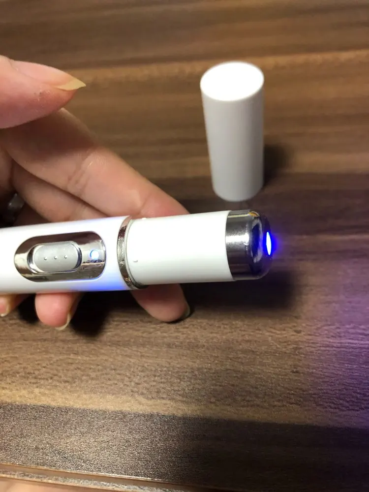 Varicose Veins Pen Relieves Pain & Improves Circulation photo review