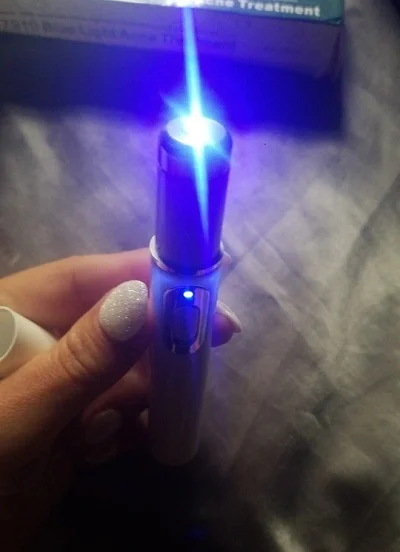 Varicose Veins Pen Relieves Pain & Improves Circulation photo review